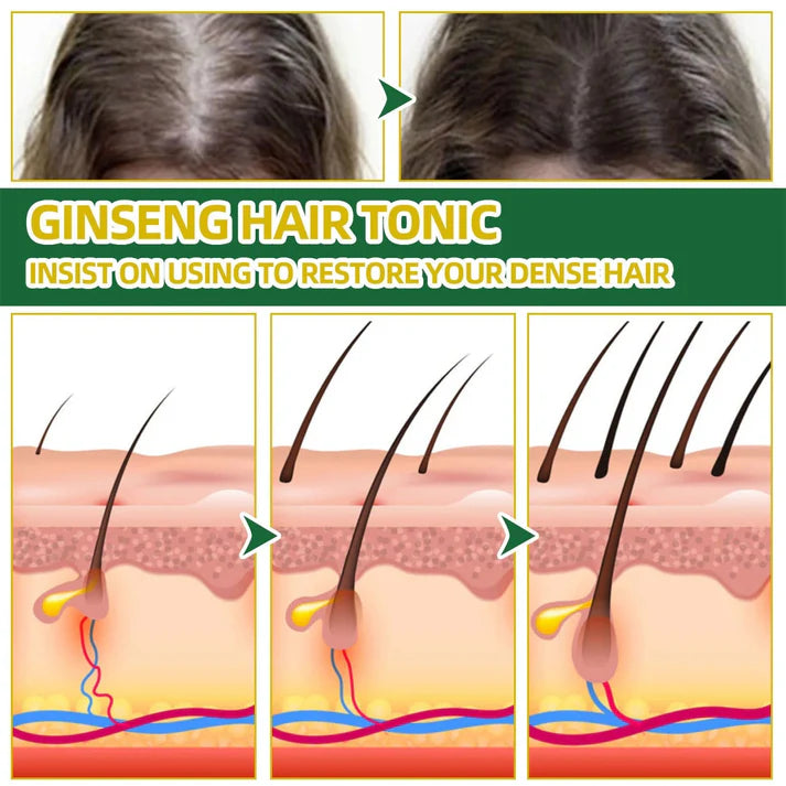 OUHOE-Crecimiento de Cabello