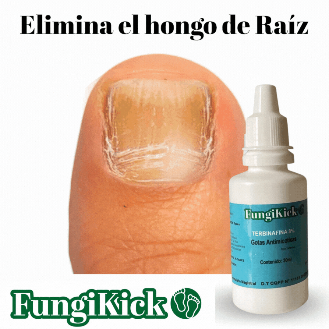 FUNGIKICK-Gota para hongos uñas