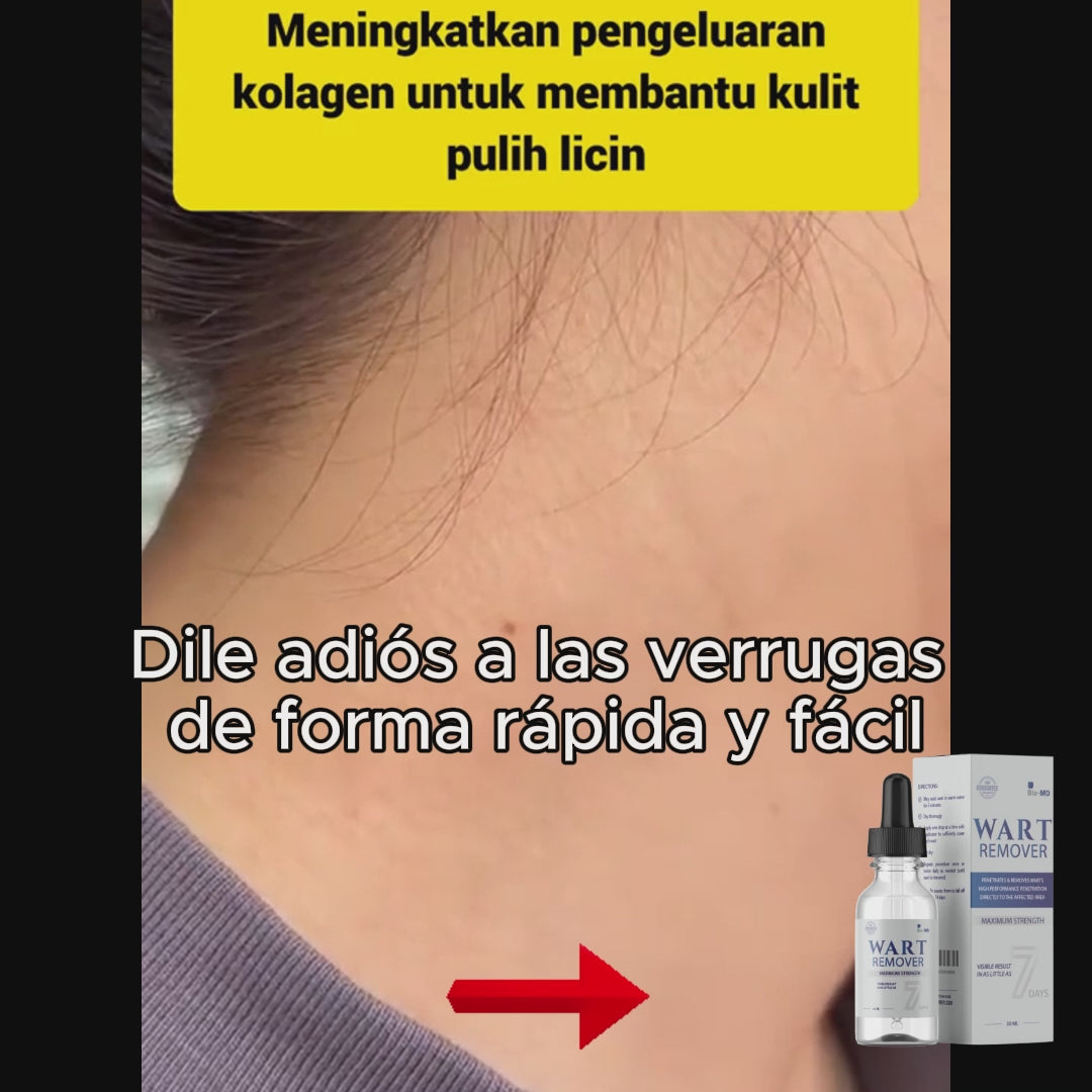 WART REMOVER