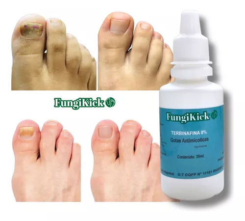 FUNGIKICK-Gota para hongos uñas